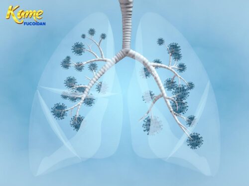 Phương pháp điều trị ung thư phổi mới nhất 2024